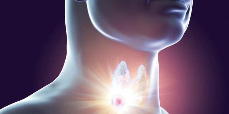 טיפול בבלוטת התריס