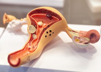 גידול ברחם טיפול נוסף שכדאי לשלב