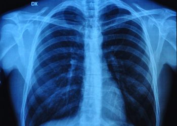 סובלים מבעיות בריאות כל מה שחשוב לדעת